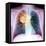 Lung Cancer, X-ray-Du Cane Medical-Framed Stretched Canvas