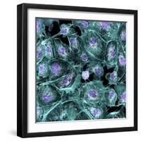 Lung Cells, Fluorescent Micrograph-Dr. Torsten Wittmann-Framed Premium Photographic Print