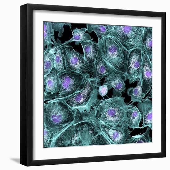 Lung Cells, Fluorescent Micrograph-Dr. Torsten Wittmann-Framed Premium Photographic Print