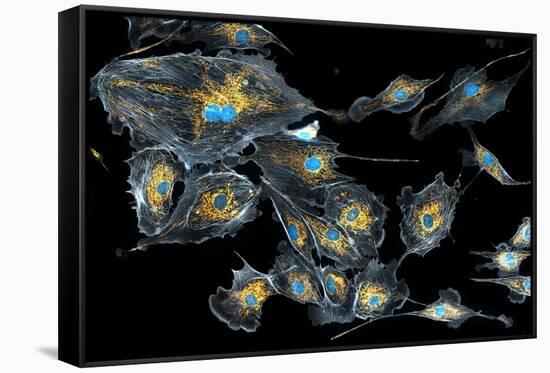Lung Cells, Fluorescent Micrograph-Dr. Torsten Wittmann-Framed Stretched Canvas