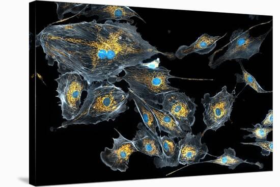 Lung Cells, Fluorescent Micrograph-Dr. Torsten Wittmann-Stretched Canvas