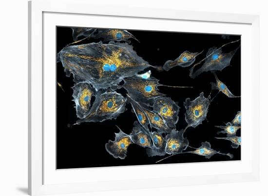 Lung Cells, Fluorescent Micrograph-Dr. Torsten Wittmann-Framed Photographic Print