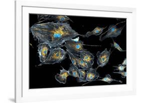 Lung Cells, Fluorescent Micrograph-Dr. Torsten Wittmann-Framed Photographic Print