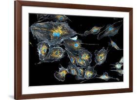 Lung Cells, Fluorescent Micrograph-Dr. Torsten Wittmann-Framed Photographic Print