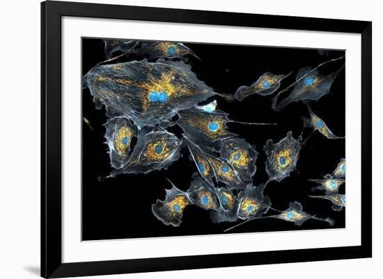 Lung Cells, Fluorescent Micrograph-Dr. Torsten Wittmann-Framed Photographic Print