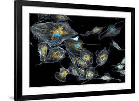 Lung Cells, Fluorescent Micrograph-Dr. Torsten Wittmann-Framed Photographic Print