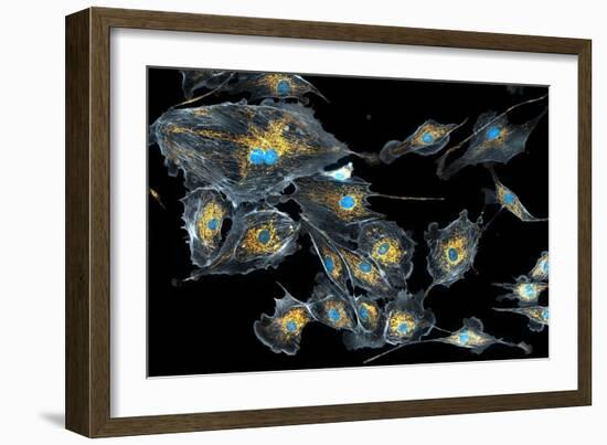 Lung Cells, Fluorescent Micrograph-Dr. Torsten Wittmann-Framed Photographic Print