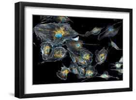 Lung Cells, Fluorescent Micrograph-Dr. Torsten Wittmann-Framed Photographic Print