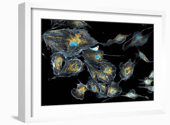 Lung Cells, Fluorescent Micrograph-Dr. Torsten Wittmann-Framed Photographic Print