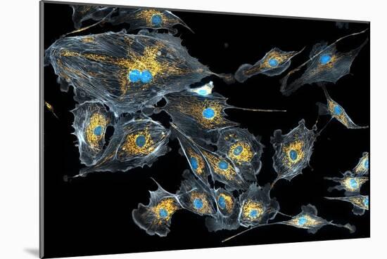 Lung Cells, Fluorescent Micrograph-Dr. Torsten Wittmann-Mounted Photographic Print