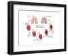 Lung Damage Leading to Emphysema-Monica Schroeder-Framed Art Print