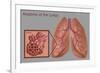 Lungs and Alveoli-Gwen Shockey-Framed Giclee Print