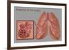 Lungs and Alveoli-Gwen Shockey-Framed Giclee Print