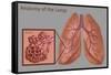 Lungs and Alveoli-Gwen Shockey-Framed Stretched Canvas