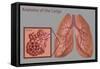 Lungs and Alveoli-Gwen Shockey-Framed Stretched Canvas