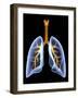 Lungs And Bronchial Tree, Artwork-PASIEKA-Framed Photographic Print