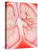 Lungs with Bronchitis-John Bavosi-Stretched Canvas