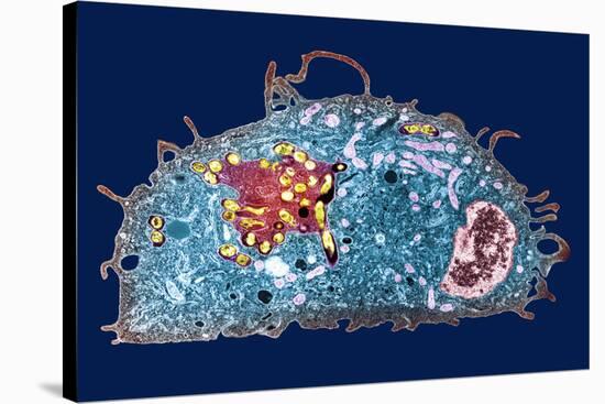 Macrophage And Tuberculosis Vaccine, TEM-Science Photo Library-Stretched Canvas