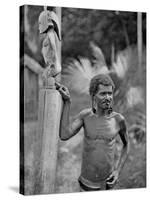 Malformation of the Ears, Solomon Islands, 1920-JW Beattie-Stretched Canvas