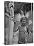 Malformation of the Ears, Solomon Islands, 1920-JW Beattie-Stretched Canvas