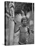 Malformation of the Ears, Solomon Islands, 1920-JW Beattie-Stretched Canvas