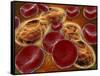 Malria Spores in the Human Blood Stream-null-Framed Stretched Canvas