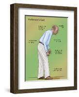 Man with Parkinson's Disease, Illustration-Monica Schroeder-Framed Giclee Print