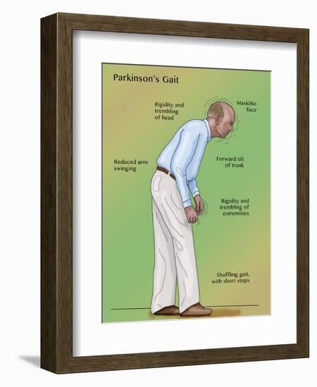 Man with Parkinson's Disease, Illustration-Monica Schroeder-Framed Giclee Print