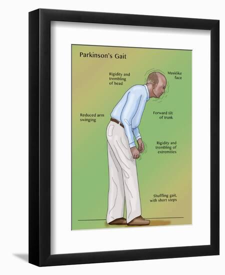 Man with Parkinson's Disease, Illustration-Monica Schroeder-Framed Giclee Print