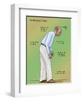 Man with Parkinson's Disease, Illustration-Monica Schroeder-Framed Giclee Print