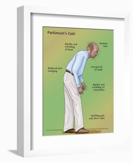 Man with Parkinson's Disease, Illustration-Monica Schroeder-Framed Giclee Print