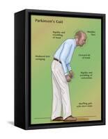 Man with Parkinson's Disease, Illustration-Monica Schroeder-Framed Stretched Canvas