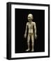 Mannequin d'acupuncture-null-Framed Giclee Print