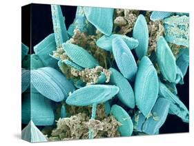 Marine Diatom-Micro Discovery-Stretched Canvas