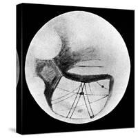 Martian Double 'Canals' 'Phison' and 'Euphrates' as Observed on 18 November 1894-null-Stretched Canvas