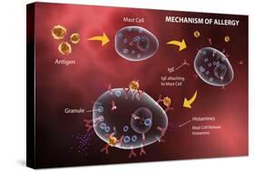 Mast Cell Releasing Histamine Due to Allergic Reaction-Stocktrek Images-Stretched Canvas