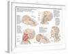 Medical Chart Showing the Range of Injuries to the Human Neck Caused by Whiplash-null-Framed Art Print