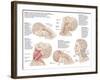 Medical Chart Showing the Range of Injuries to the Human Neck Caused by Whiplash-null-Framed Art Print