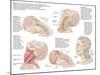 Medical Chart Showing the Range of Injuries to the Human Neck Caused by Whiplash-null-Mounted Art Print