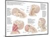 Medical Chart Showing the Range of Injuries to the Human Neck Caused by Whiplash-null-Mounted Art Print