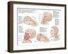 Medical Chart Showing the Range of Injuries to the Human Neck Caused by Whiplash-null-Framed Art Print