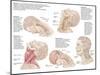 Medical Chart Showing the Range of Injuries to the Human Neck Caused by Whiplash-null-Mounted Art Print