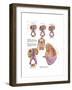 Medical Chart Showing the Signs and Symptoms of Kidney Cancer-null-Framed Art Print