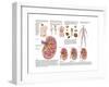 Medical Chart Showing the Signs and Symptoms of Kidney Stones-null-Framed Art Print