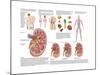 Medical Chart Showing the Signs and Symptoms of Kidney Stones-null-Mounted Art Print