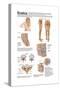 Medical Chart Showing the Signs and Symptoms of Sciatica-null-Stretched Canvas
