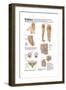 Medical Chart Showing the Signs and Symptoms of Sciatica-null-Framed Art Print