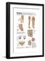 Medical Chart Showing the Signs and Symptoms of Sciatica-null-Framed Art Print