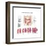 Medical Illustration Depicting the Different Stages of Colon Cancer-null-Framed Art Print