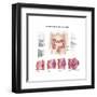 Medical Illustration Depicting the Different Stages of Colon Cancer-null-Framed Art Print